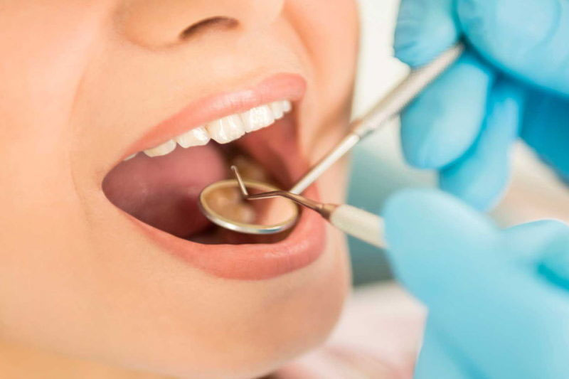 Diş Eti ve Ağız Boşlukları Hastalıkları